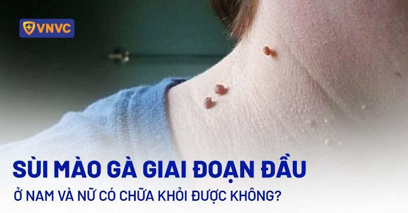 Hình ảnh một người ngồi thư giãn bên cửa sổ, nhìn ra ngoài, hoặc đang đi dạo nhẹ nhàng, thể hiện giai đoạn ủ bệnh trong tư duy.