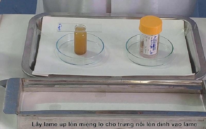 Sinh viên đang quan sát mẫu bệnh phẩm ký sinh trùng dưới kính hiển vi trong phòng thí nghiệm.