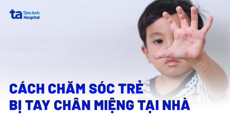 Chăm sóc trẻ bị tay chân miệng tại nhà