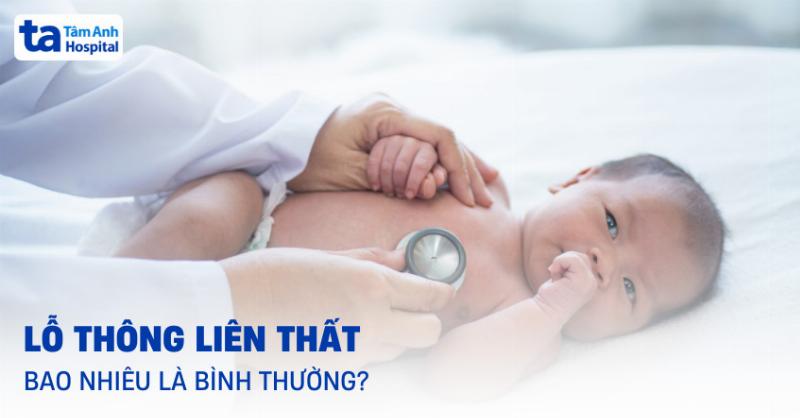 Kích thước tim ở trẻ em bình thường qua siêu âm