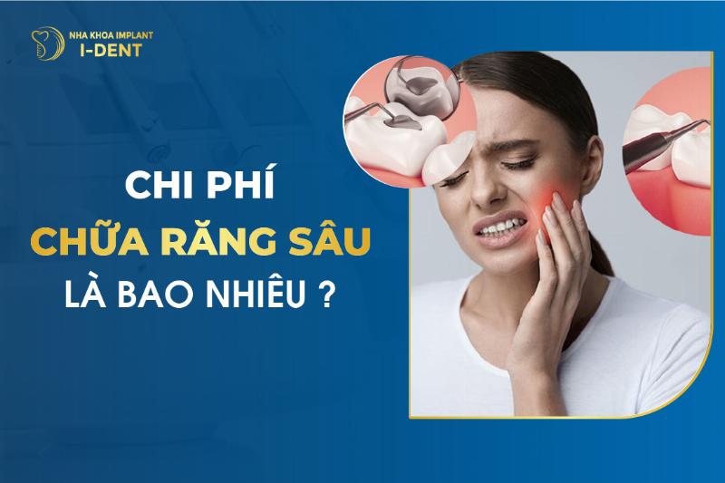 Trám răng tại nha sĩ