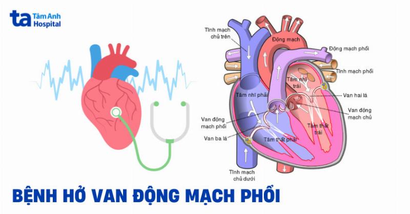 Van động mạch chủ và van động mạch phổi bình thường qua siêu âm